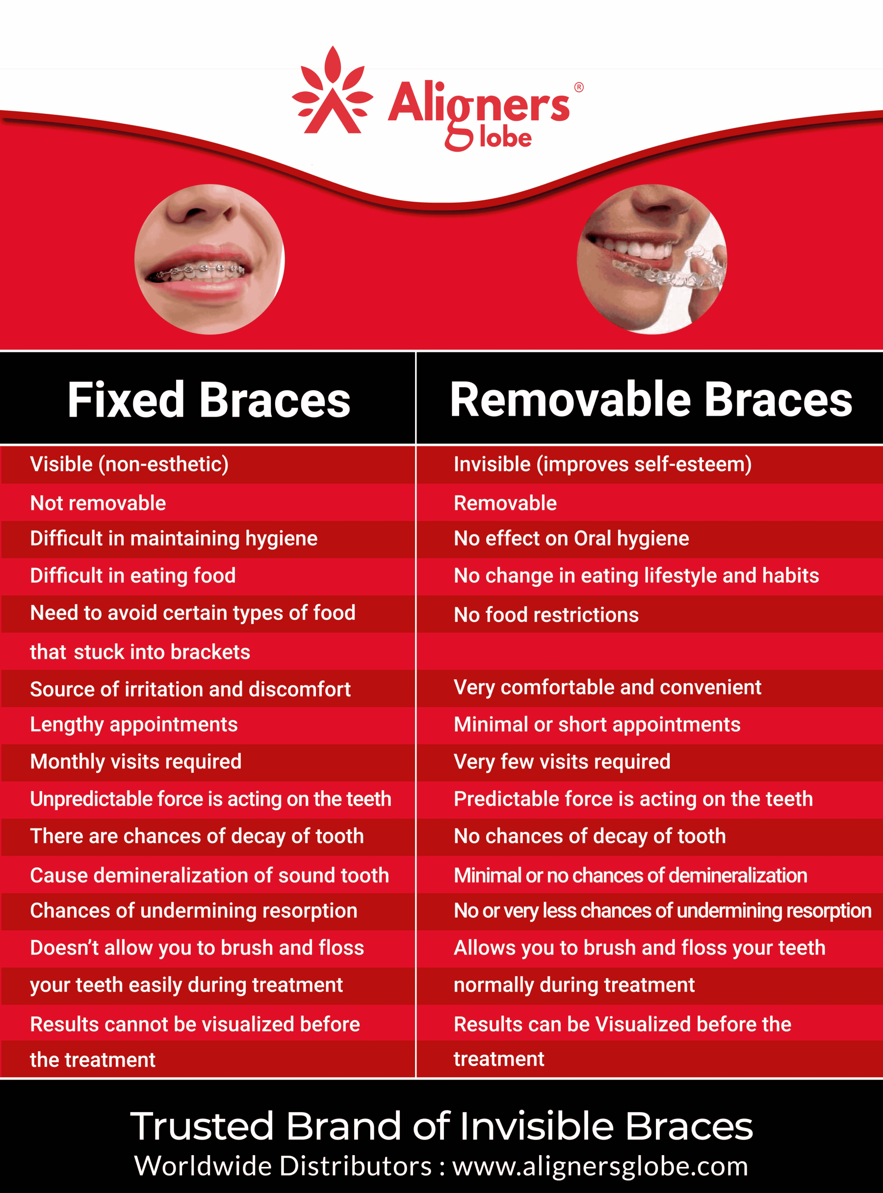 Comparison between Fixed Braces and Removable Braces